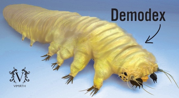 demodex