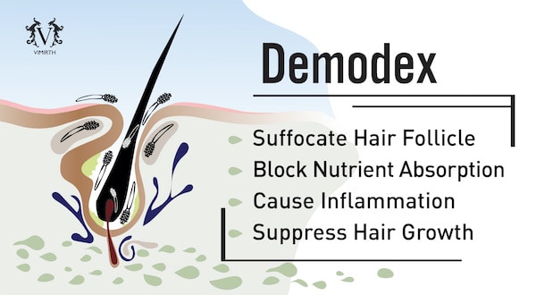 hair loss demodex