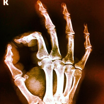 joint x-ray